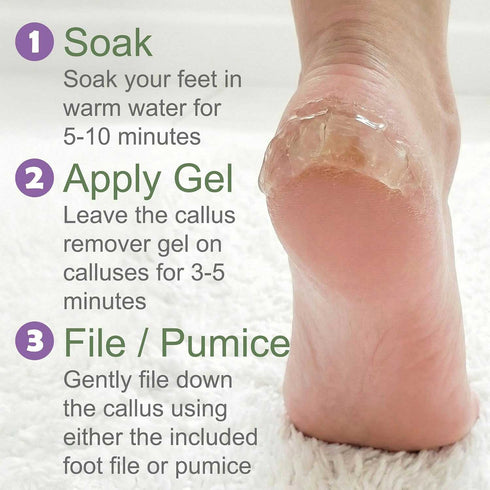 EntreFeet Callus Remover Gel Kit - Extra Strength | Wholesale